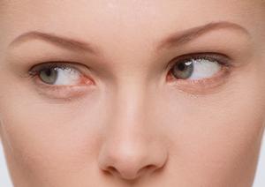 大阪で脂肪吸引を超える方法が登場